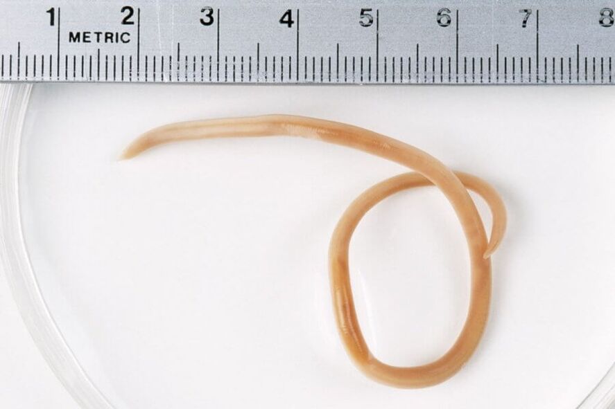 Ascaris is a round worm that lives in the human body